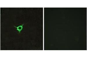 Immunofluorescence analysis of LOVO cells, using CNR1 Antibody.