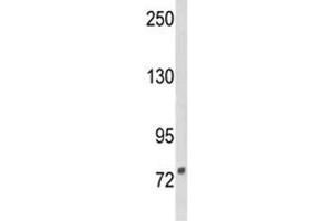 Western blot analysis of DGCR8 antibody and NCI-H460 lysate. (DGCR8 antibody  (AA 439-466))