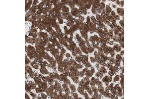 Immunohistochemical staining (Formalin-fixed paraffin-embedded sections) of human liver shows strong cytoplasmic positivity in hepatocytes. (Glucose-6-Phosphate Dehydrogenase antibody  (AA 43-154))
