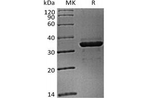 Western Blotting (WB) image for Fibrinogen-Like 1 (FGL1) (Active) protein (His tag) (ABIN7321019) (FGL1 Protein (His tag))