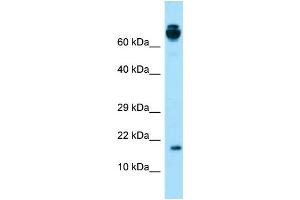 Western Blotting (WB) image for anti-Vitamin K-dependent protein C (PROC) (Middle Region) antibody (ABIN2774395) (PROC antibody  (Middle Region))