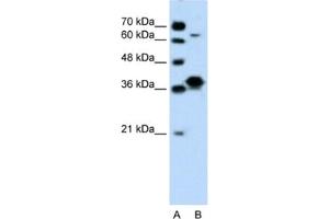 Western Blotting (WB) image for anti-FOS-Like Antigen 1 (FOSL1) antibody (ABIN2460206) (FOSL1 antibody)