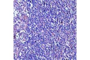 TUBA4A antibody immunohistochemistry analysis in formalin fixed and paraffin embedded human tonsil tissue. (TUBA4A antibody  (AA 417-446))