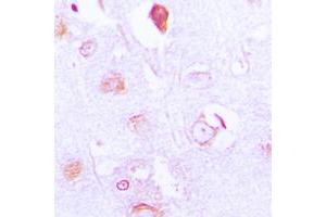 Immunohistochemical analysis of FXR2 staining in human brain formalin fixed paraffin embedded tissue section. (FXR2 antibody  (C-Term))