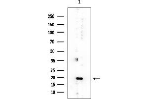 anti-Protein Phosphatase 1, Regulatory (Inhibitor) Subunit 14B (PPP1R14B) (Internal Region) antibody