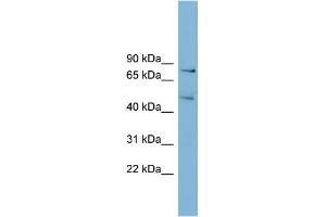 WB Suggested Anti-BOP1 Antibody Titration:  0.