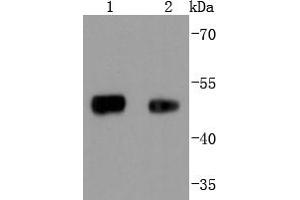 Lane 1: 293 lysates, Lane 2: Mouse lung lysates probed with FOXA1 (5F7) Monoclonal Antibody  at 1:1000 overnight at 4˚C. (FOXA1 antibody)