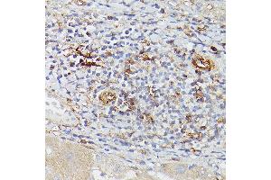 Immunohistochemistry of paraffin-embedded human liver using ENTPD1/CD39 Rabbit pAb (ABIN1679729, ABIN3018088, ABIN3018089 and ABIN6220354) at dilution of 1:25 (40x lens). (CD39 antibody  (AA 1-180))