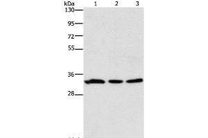 Western Blot analysis of 293T and Human colon cancer tissue, 231 cell using GPA33 Polyclonal Antibody at dilution of 1:600 (GPA33 antibody)