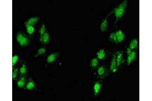 Immunofluorescent analysis of Hela cells using ABIN7160518 at dilution of 1:100 and Alexa Fluor 488-congugated AffiniPure Goat Anti-Rabbit IgG(H+L) (MYF6 antibody  (AA 26-232))