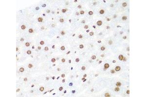 Immunohistochemistry of paraffin-embedded Mouse liver using Argonaute-2 Polyclonal Antibody at dilution of 1:100 (40x lens). (AGO2 antibody)