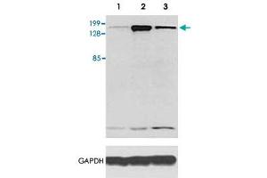 Western blot analysis of Als2 monoclonal antibody  in mouse neuronal tissue : brain stem (Lane 1), cerebellum (Lane 2) and cortex (Lane 3) transfected with full length Als2-EGFP fusion construct (expected size 220 KDa). (ALS2 antibody  (AA 221-321))