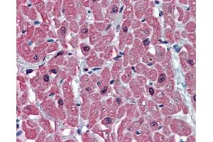 Anti-TNNC1 antibody IHC of human heart.