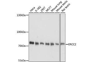Western blot analysis of extracts of various cell lines, using ERCC2 antibody. (ERCC2 antibody)