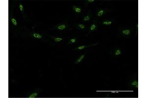 Immunofluorescence (IF) image for anti-Aryl Hydrocarbon Receptor Interacting Protein-Like 1 (AIPL1) (AA 1-384) antibody (ABIN525384)