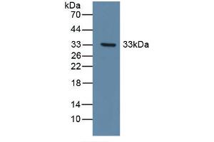 Detection of Recombinant DDR1, Human using Polyclonal Antibody to Discoidin Domain Receptor Family, Member 1 (DDR1) (DDR1 antibody  (AA 568-829))