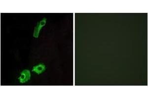 Immunofluorescence analysis of HeLa cells, using GPR151 Antibody. (GPR151 antibody  (AA 276-325))