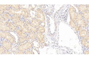 Detection of DNASEII in Human Kidney Tissue using Polyclonal Antibody to Deoxyribonuclease II (DNASEII) (Deoxyribonuclease II (AA 19-360) antibody)