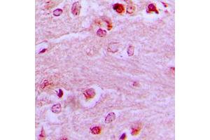 Immunohistochemical analysis of EZH1 staining in human brain formalin fixed paraffin embedded tissue section. (EZH1 antibody  (Center))