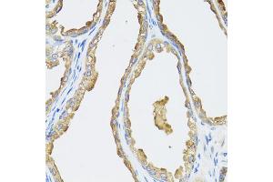 Immunohistochemistry of paraffin-embedded human prostate using CYP19A1 antibody (ABIN1872157) at dilution of 1:100 (40x lens).