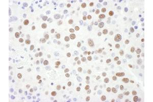 Immunohistochemistry (IHC) image for anti-Small Nuclear Ribonucleoprotein D3 Polypeptide 18kDa (SNRPD3) (AA 76-126) antibody (ABIN7454989)