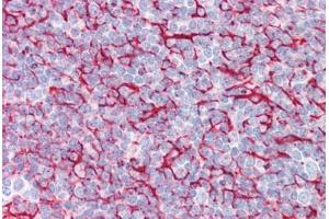 Anti-BRAF antibody IHC staining of human tonsil. (BRAF antibody  (AA 411-460))