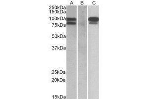 HEK293 lysate (10 µg protein in RIPA buffer) overexpressing Human PCSK9 with C-terminal MYC tag probed with AP22407PU-N (0. (PCSK9 antibody  (Internal Region))