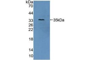 Western blot analysis of recombinant Human AZIN1. (Antizyme Inhibitor 1 antibody  (Lys290))