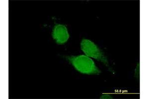 Immunofluorescence of purified MaxPab antibody to NCK1 on HeLa cell.