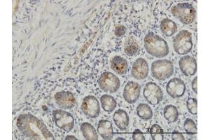 Image no. 1 for anti-Interleukin 37 (IL37) (AA 1-219) antibody (ABIN599218) (IL-37 antibody  (AA 1-219))