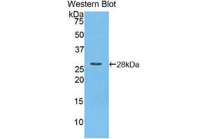 Western blot analysis of the recombinant protein. (iPLA2 antibody  (AA 481-702))