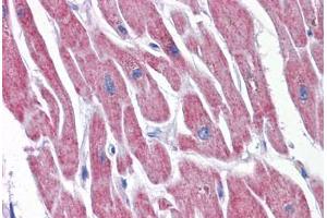 Human Heart: Formalin-Fixed, Paraffin-Embedded (FFPE) (ATP5E antibody  (AA 1-52))