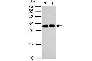 WB Image Sample (30 ug of whole cell lysate) A: Jurkat B: Raji 12% SDS PAGE antibody diluted at 1:5000 (SLC25A11 antibody)
