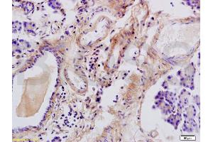 Formalin-fixed and paraffin embedded rat pancreas tissue labeled with Anti-Tenascin C/Tn-C Polyclonal Antibody, Unconjugated (ABIN736761) at 1:200 followed by conjugation to the secondary antibody and DAB staining (TNC antibody  (AA 1001-1100))