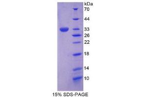 SDS-PAGE (SDS) image for Protein tyrosine Phosphatase, Receptor Type, H (PTPRH) (AA 844-1096) protein (His tag) (ABIN2126542) (PTPRH Protein (AA 844-1096) (His tag))