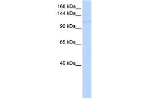 NEDD9 antibody used at 1 ug/ml to detect target protein. (NEDD9 antibody  (Middle Region))