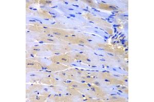 Immunohistochemistry of paraffin-embedded mouse heart using CUL2 antibody (ABIN5975808) at dilution of 1/200 (40x lens). (Cullin 2 antibody)