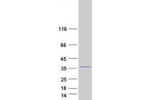 Validation with Western Blot (GIMAP5 Protein (Myc-DYKDDDDK Tag))