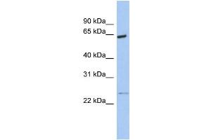 WB Suggested Anti-PCTK1 Antibody Titration:  0. (CDK16 antibody  (N-Term))