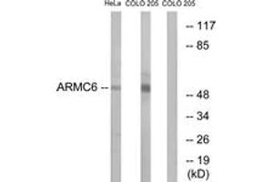 Western blot analysis of extracts from HeLa/COLO cells, using ARMC6 Antibody. (ARMC6 antibody  (AA 431-480))
