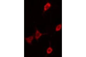 ABIN6276361 staining  A2780 cells by IF/ICC.
