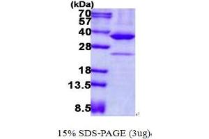 Image no. 1 for Protein Kinase, AMP-Activated, beta 2 Non-Catalytic Subunit (PRKAB2) protein (His tag) (ABIN1098705)