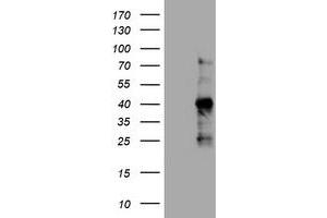 Image no. 1 for anti-Antigen Identified By Monoclonal Antibody Ki-67 (MKI67) (AA 2924-3256) antibody (ABIN1491346) (Ki-67 antibody  (AA 2924-3256))