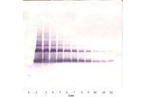 Image no. 2 for anti-Vascular Endothelial Growth Factor A (VEGFA) antibody (ABIN465403) (VEGFA antibody)