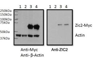 RWPE1 cell lysate overexpressing human ZIC2-MYC tag tested with ZIC2 antibody (0. (ZIC2 antibody)