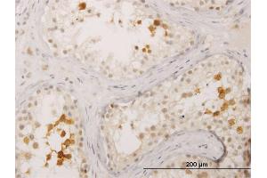 Immunoperoxidase of monoclonal antibody to BOLL on formalin-fixed paraffin-embedded human testis.