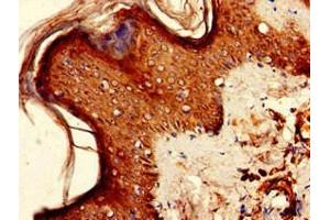 Immunohistochemistry of paraffin-embedded human skin tissue using ABIN7157511 at dilution of 1:100 (KIR2DS2 antibody  (AA 104-241))