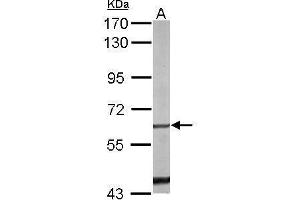 WB Image Sample (50 ug of whole cell lysate) A: mouse liver 7. (NR4A1 antibody  (C-Term))