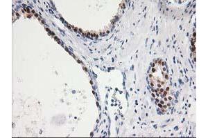 Immunohistochemical staining of paraffin-embedded Human prostate tissue using anti-SMS mouse monoclonal antibody. (SMS antibody)