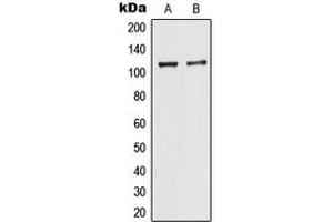 Western blot analysis of TIF1 alpha expression in MCF7 (A), HeLa (B) whole cell lysates. (TRIM24 antibody  (C-Term))